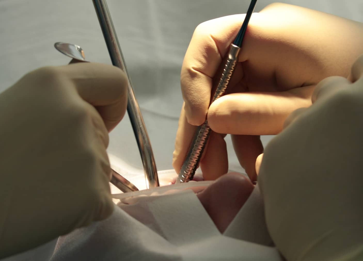 Chirurgie orale à Asnières sur Seine | Chirurgie buccale | Cabinet dentaire Monsenego & Fils