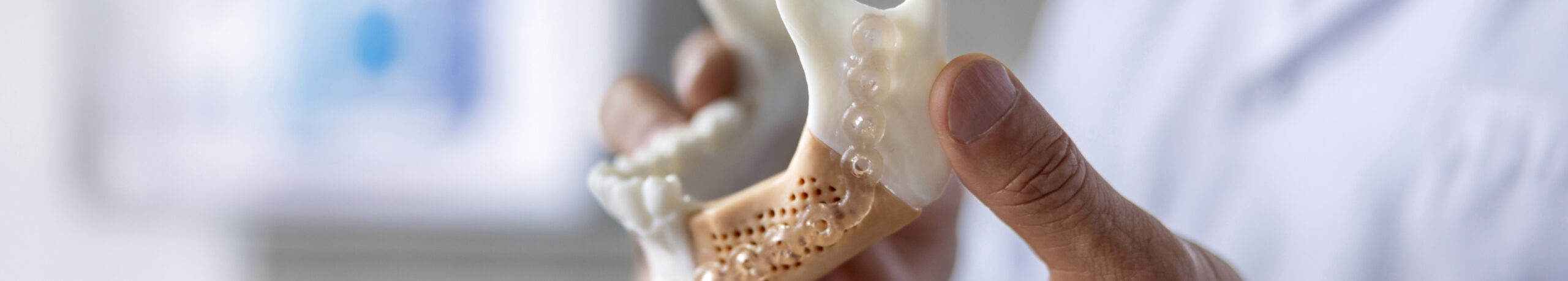 Risques greffe osseuse | Monsenego & Fils | Asnières sur Seine