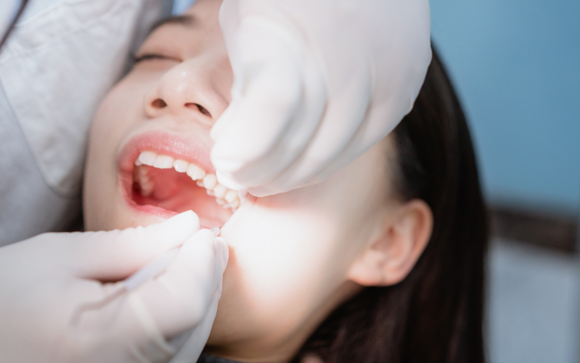 Extraction dents de sagesse
