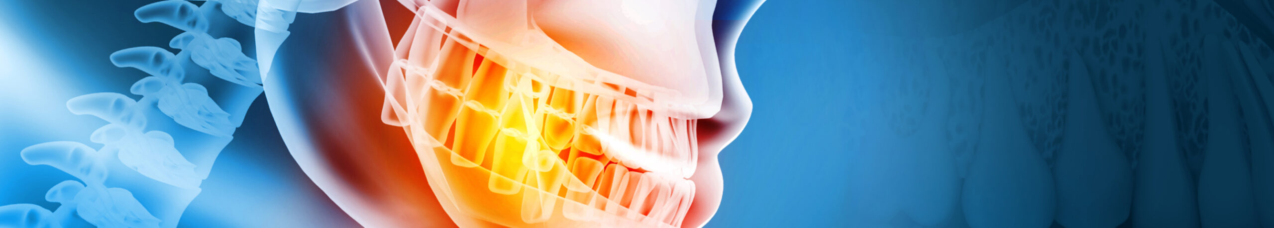 Implant dentaire santé osseuse pourquoi densité osseuse cruciale | Monsenego & Fils | Asnières sur Seine