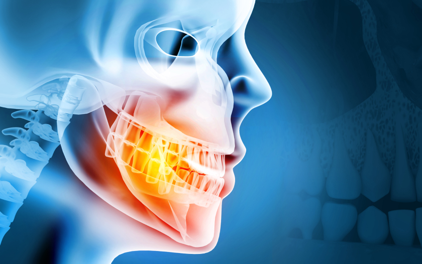 Implant dentaire santé osseuse pourquoi densité osseuse cruciale | Monsenego & Fils | Asnières sur Seine