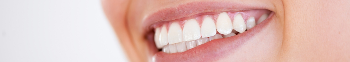 pourquoi faire poser implant dentaire | Monsenego & Fils | Asnières sur Seine