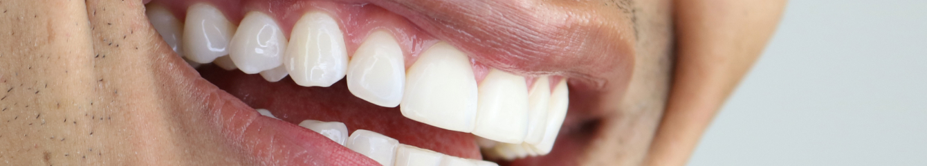 combien temps entre extraction pose implant | Monsenego & Fils | Asnières sur Seine