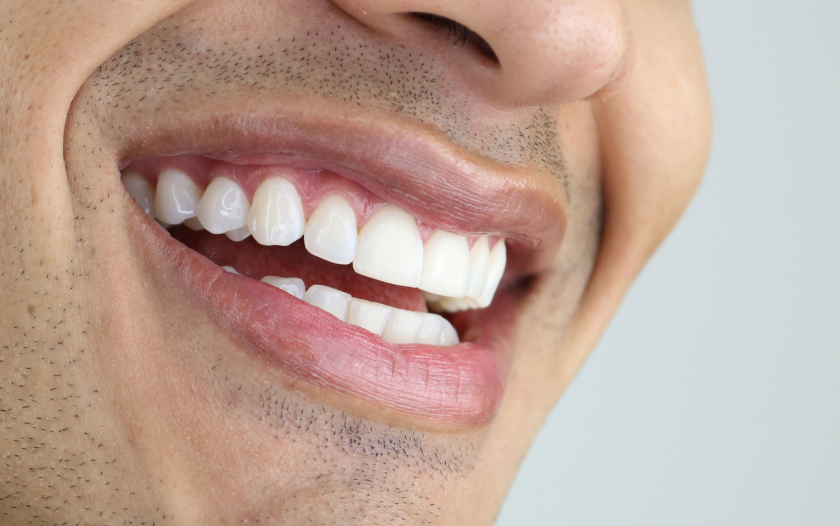 combien temps entre extraction pose implant | Monsenego & Fils | Asnières sur Seine